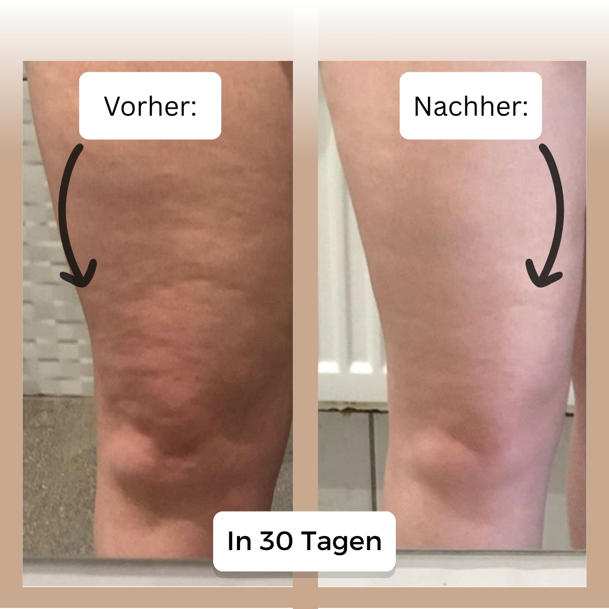 HealthyShine - Tiefen Massagegerät